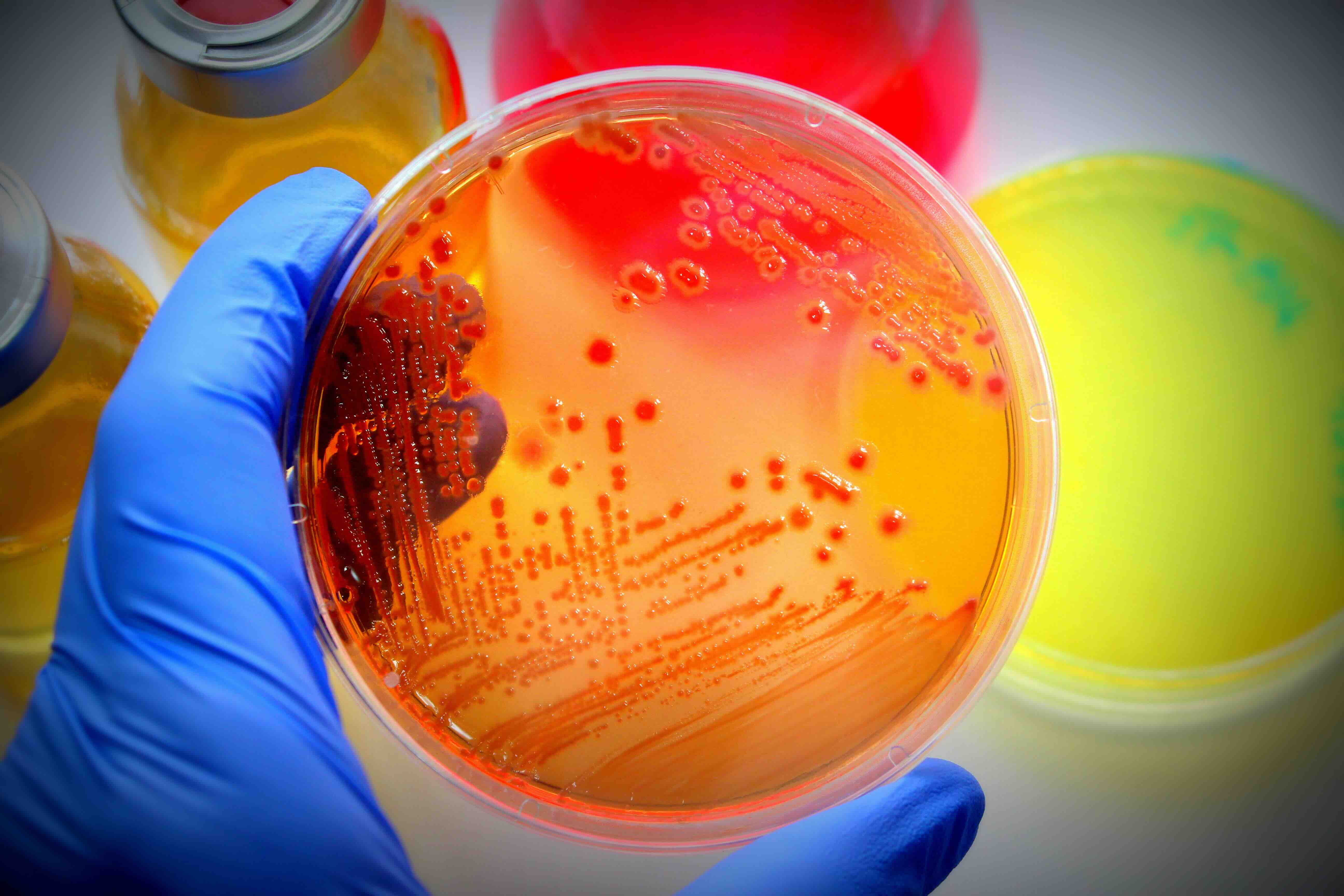 Enzyme Engineering